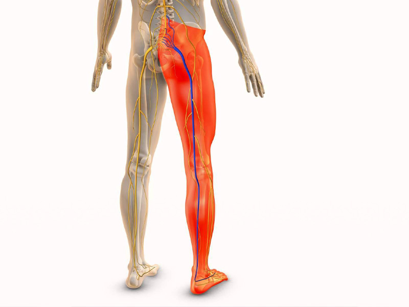 Ejercicios de fisioterapia para la ciática