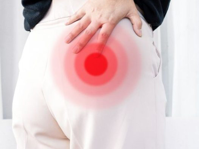Diferencias entre lumbago y ciática para prevenir su aparición