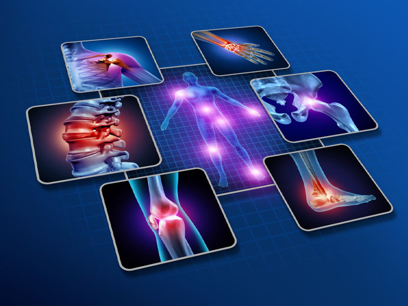 Fisioterapia para la fibromialgia: Tratamientos para aliviar el dolor
